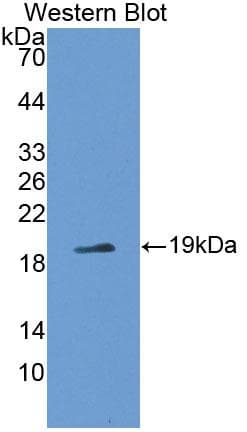 SRI / Sorcin Antibody (aa29-169)