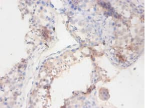 Polyclonal Rabbit anti-Dog BCHE / Cholinesterase Antibody (WB)