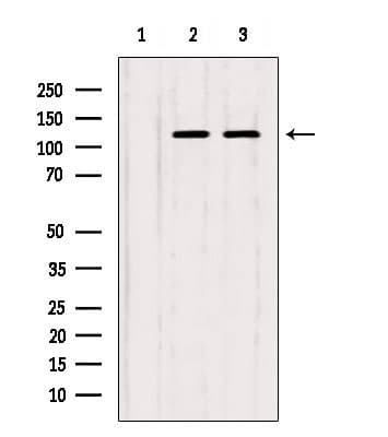 Polyclonal Rabbit anti-Human ITPKB Antibody (IF, WB)