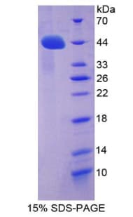 Rat ACE2 / ACE-2 Protein (Recombinant His-T7)