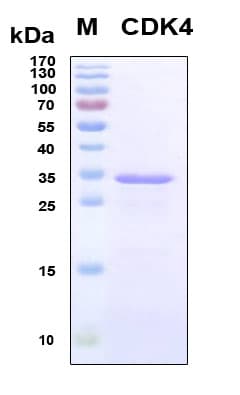 Human CDK4 Protein (Recombinant 6His, N-terminus)