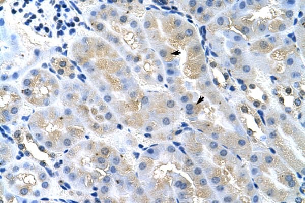 TSG101 Antibody (aa121-170, HRP)