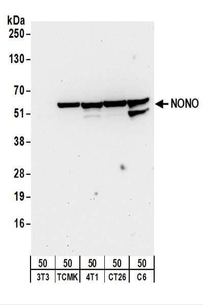 IHC-plus™ NONO / P54NRB Antibody (aa350-400)