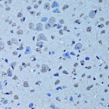 CD55 Antibody