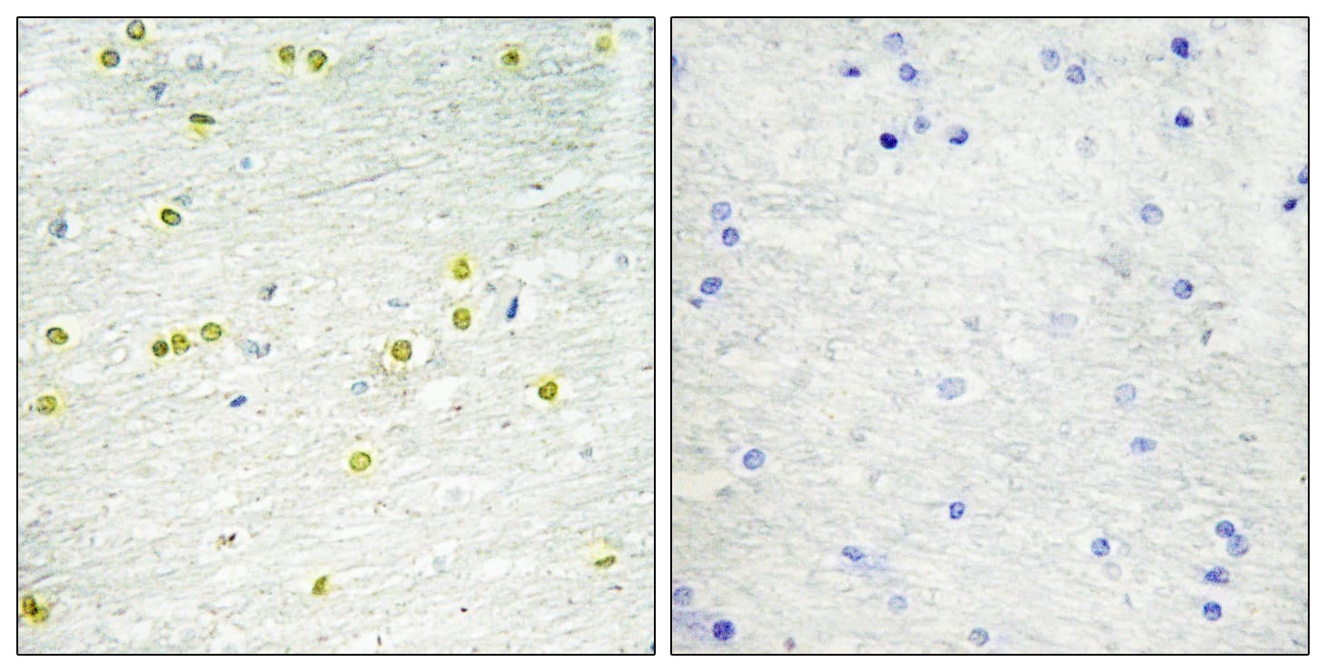 Polyclonal Rabbit anti-Human Histone H3 Antibody (aa6-55, IHC)