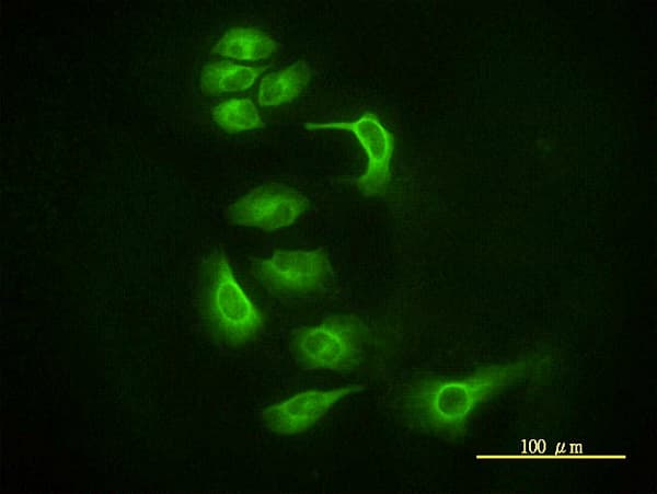 IHC-plus™ AGO2 / EIF2C2 Antibody (clone 2E12-1C9)