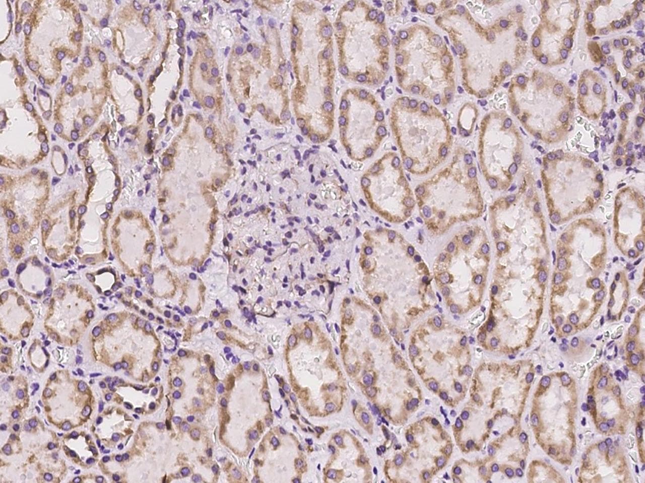 CYB5B Antibody