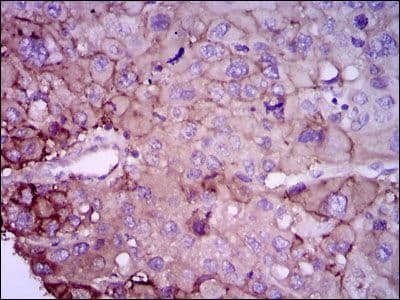 Monoclonal Mouse anti-Human RAB4A / RAB4 Antibody (clone 4E+11, IHC, WB)