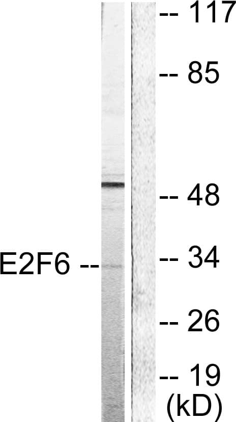IHC-plus™ Polyclonal Rabbit anti-Human E2F6 Antibody (aa141-190, IHC, WB)