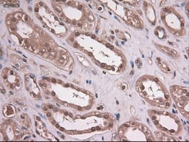 Monoclonal Mouse anti-Human EPCAM Antibody (clone OTI2C8, IHC, WB)