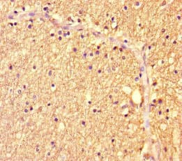ZBTB46 Antibody