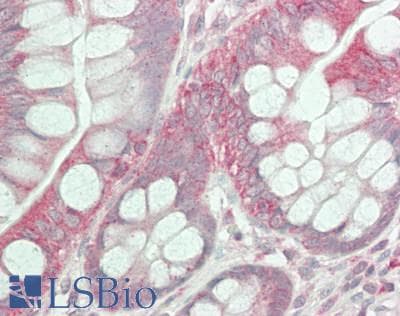 IHC-plus™ OXSR1 / OSR1 Antibody (aa375-425)