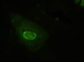 NEUROG1 / NGN1 / Neurogenin 1 Antibody (clone OTI19A11)