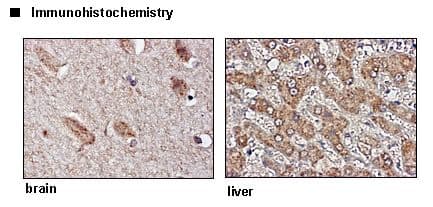 SLC6A2 / NET Antibody (N-Terminal)