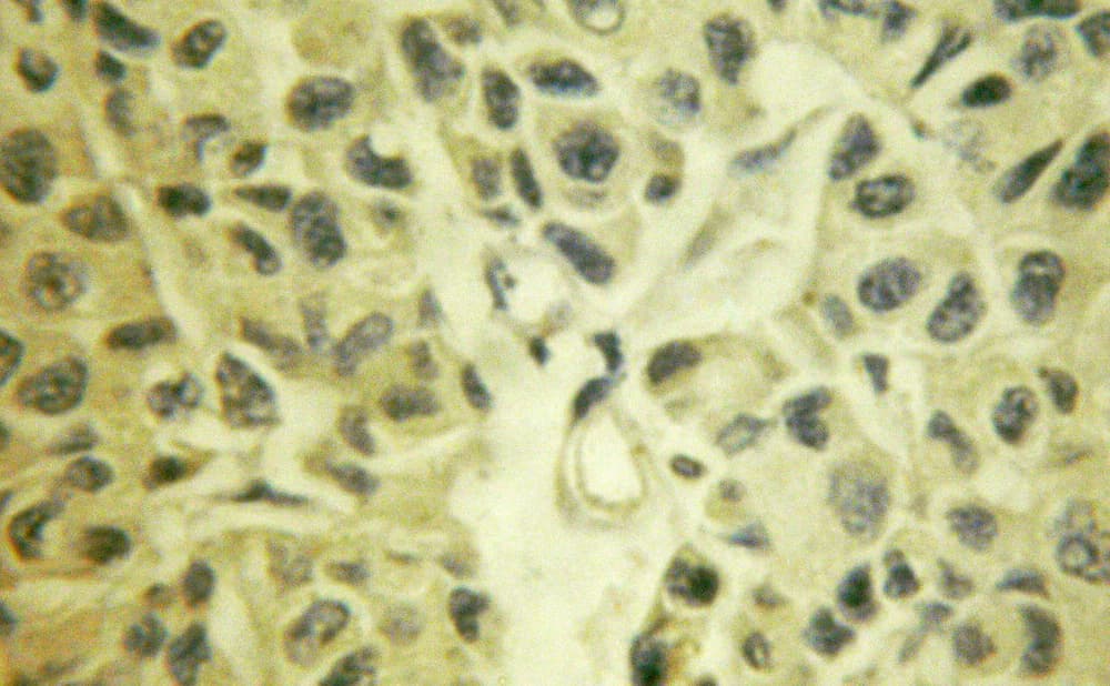 MAP3K7 / TAK1 Antibody