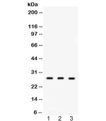 Polyclonal Rabbit anti-Human DDAH2 Antibody (IHC, WB)