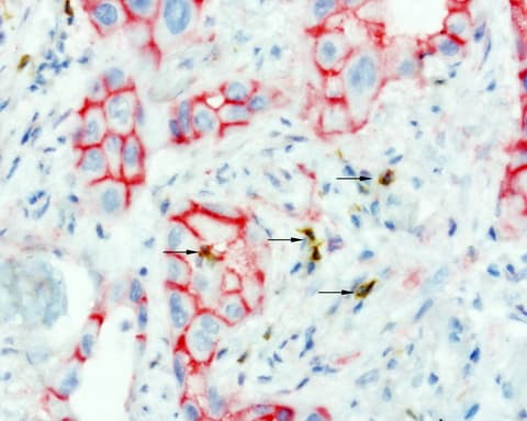 CTNNB1 / Beta Catenin Antibody (clone UMAB15)