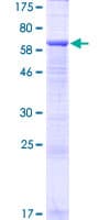 Human LINS1 Protein (Recombinant GST)
