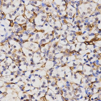 CA4 / Carbonic Anhydrase IV Antibody