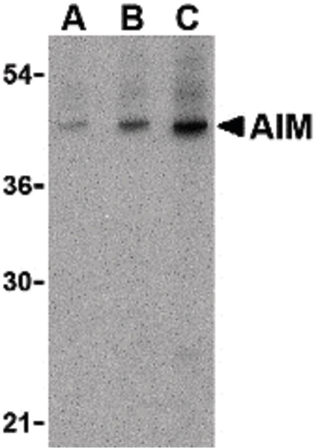 Polyclonal Rabbit anti-Human AIM / CD5L Antibody (IHC, IF, WB)
