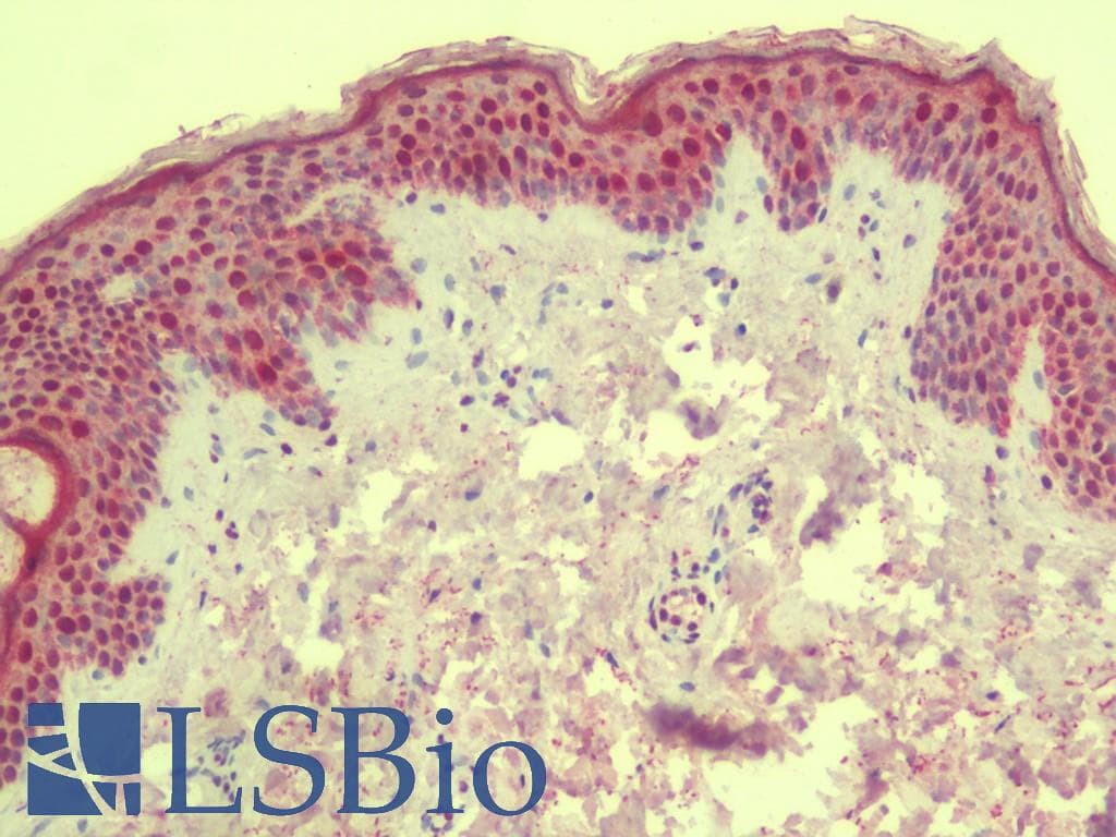 IHC-plus™ ANKLE1 Antibody