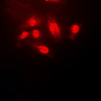 IHC-plus™ CFL1 / Cofilin Antibody (N-Terminus)