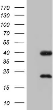 NR1I3 / CAR Antibody (aa1-236, clone OTI1C6)