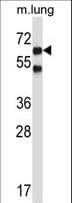 NLK Antibody (aa408-436)