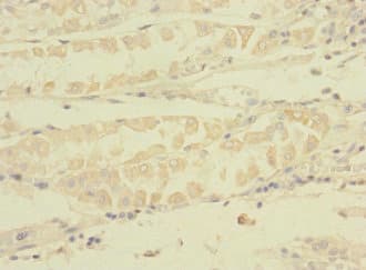 Polyclonal Rabbit anti-Human TNRC6A / GW182 Antibody