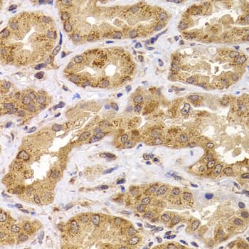 ANAPC5 / APC5 Antibody (AP)