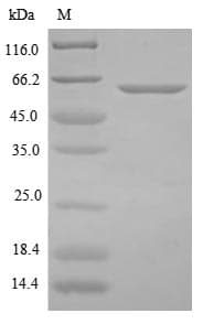 Clostridium botulinum Botulinum Neurotoxin type B Protein (Recombinant 6His-B2M, N-terminus)