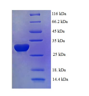 Human ID2 Protein (Recombinant His-SUMO)