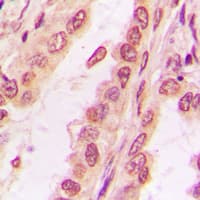 Polyclonal Rabbit anti-Human PPHLN1 Antibody (Internal, IHC, IF, WB)