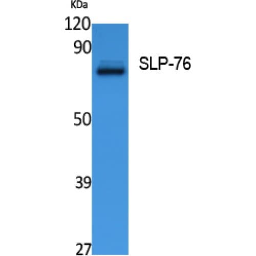 LCP2 / SLP-76 Antibody (270-350 aa, Internal)