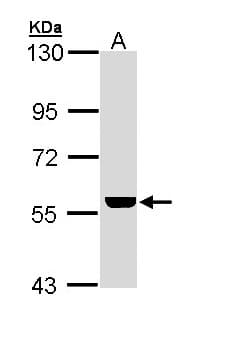 IHC-plus™ ADCK4 Antibody (aa141-460)