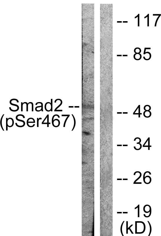 Polyclonal Rabbit anti-Human SMAD2 Antibody (phospho-Ser467, IHC, WB)