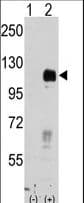 Polyclonal Rabbit anti-Human EPHB4 / EPH Receptor B4 Antibody (IHC, WB)