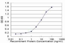 S100A8 / MRP8 Antibody (clone 1B3)