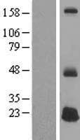 DEFB125 Protein (Over-Expression Lysate Myc-DDK (Flag))