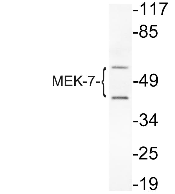 MAP2K7 / MEK7 Antibody (Ile264)