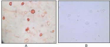 Monoclonal Mouse anti-Human Herpesvirus 8 HHV-8 K8 alpha Antibody (clone 8C12G10G1, IHC, WB)