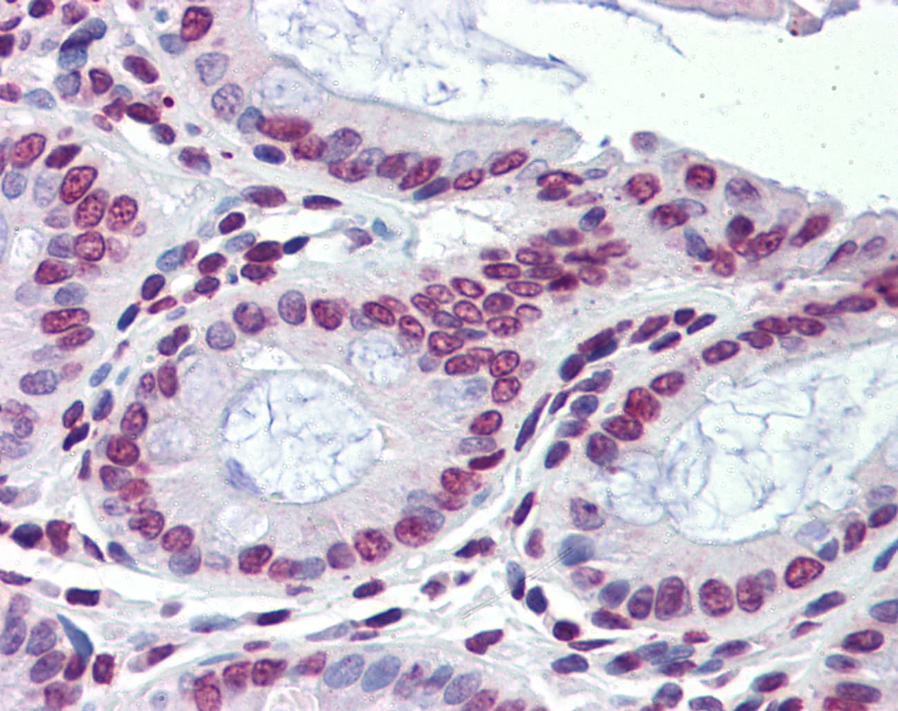 Polyclonal Rabbit anti-Human NR1H3 / LXR Alpha Antibody (C-Terminus, IHC, WB)