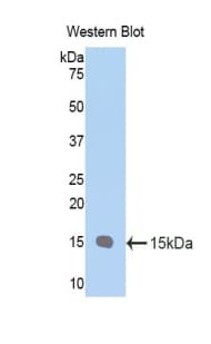 PIGR Antibody (aa135-237)