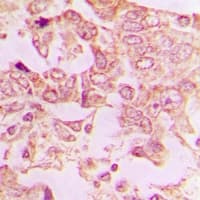 Polyclonal Rabbit anti-Human LLGL2 Antibody (IHC, WB)