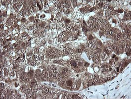 TRMT2A Antibody (clone OTI3B3)