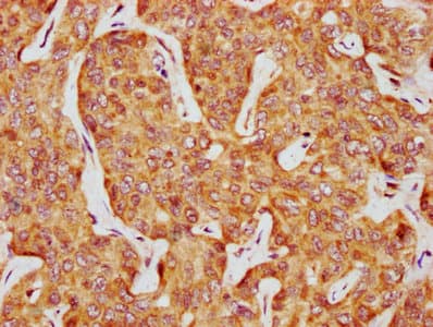 Polyclonal Rabbit anti-Human CSNK1D Antibody (IHC)