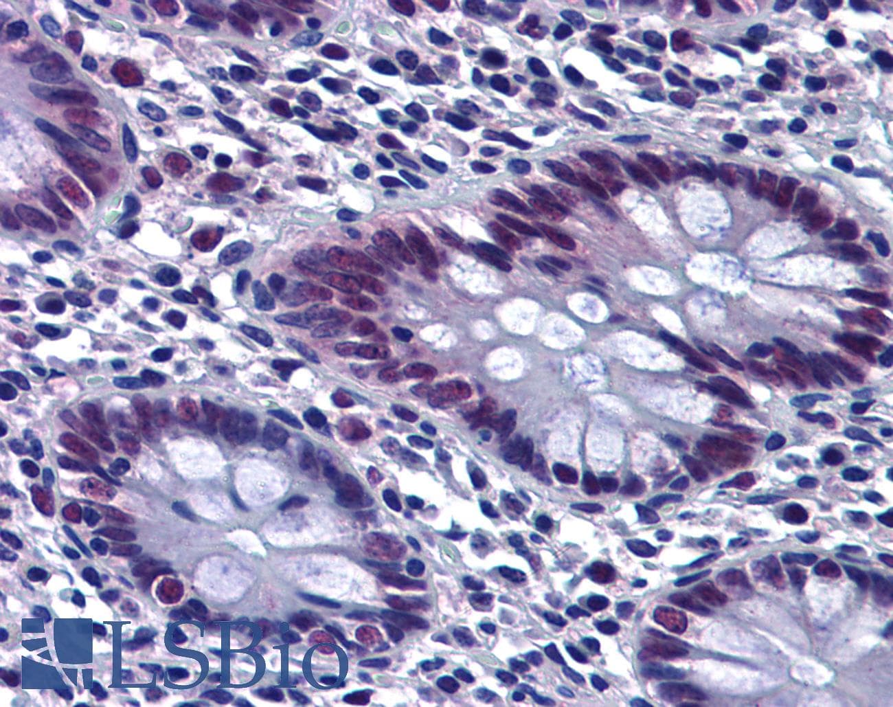 IHC-plus™ CHEK2 / CHK2 Antibody (clone 3E10)