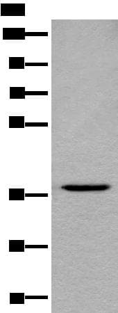 LDAH Antibody
