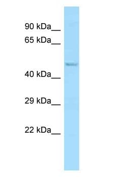 ABI1 / SSH3BP1 Antibody (aa91-140)