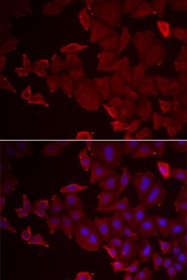 MARCKSL1 Antibody
